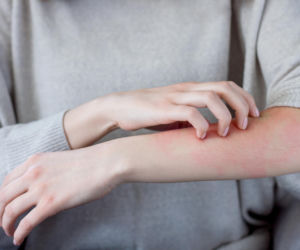 Swędząca wysypka po wyjściu na mróz? To może być sygnał alarmowy od organizmu