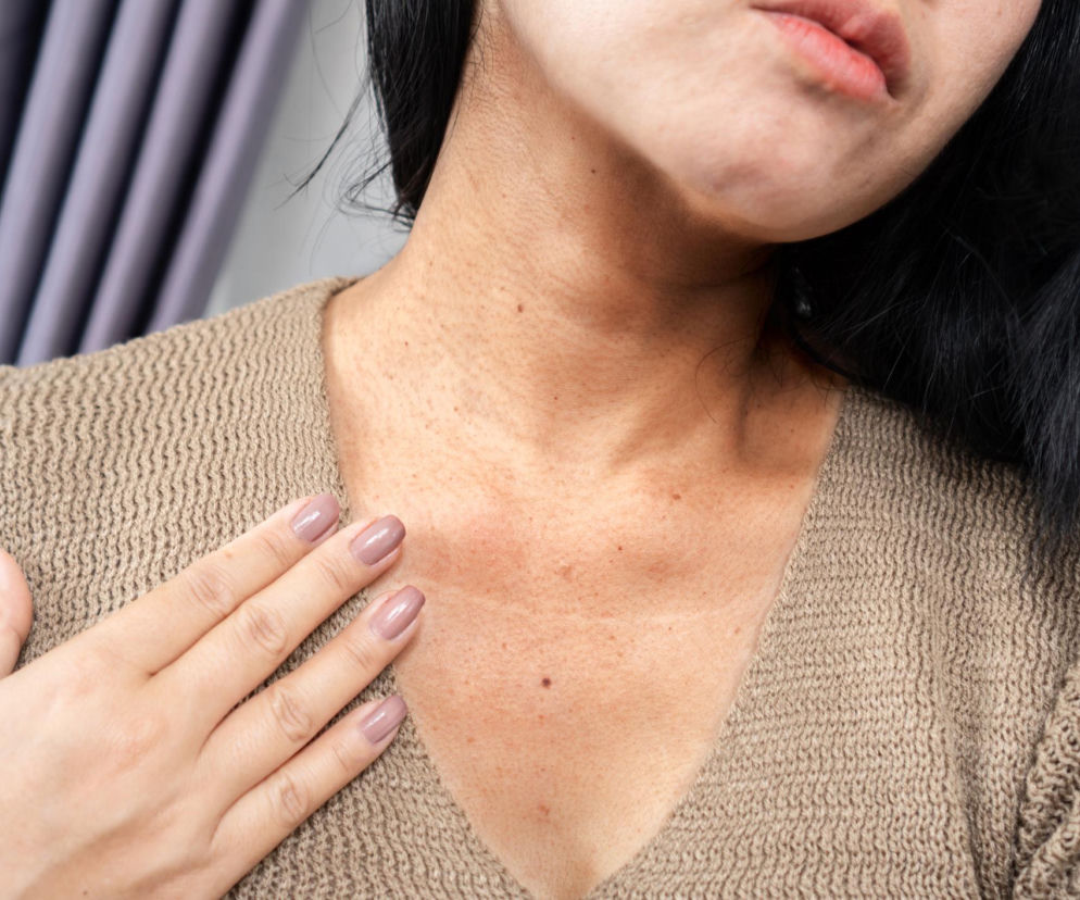 Kobieta dotyka dekoltu, który, podobnie jak jej szyja, ma widoczne zmarszczki. W tle widać ciemne zasłony. Zjawisko tech neck i zmarszczki od telefonu to nowy problem, o którym przeczytasz więcej na Poradnik Zdrowie.