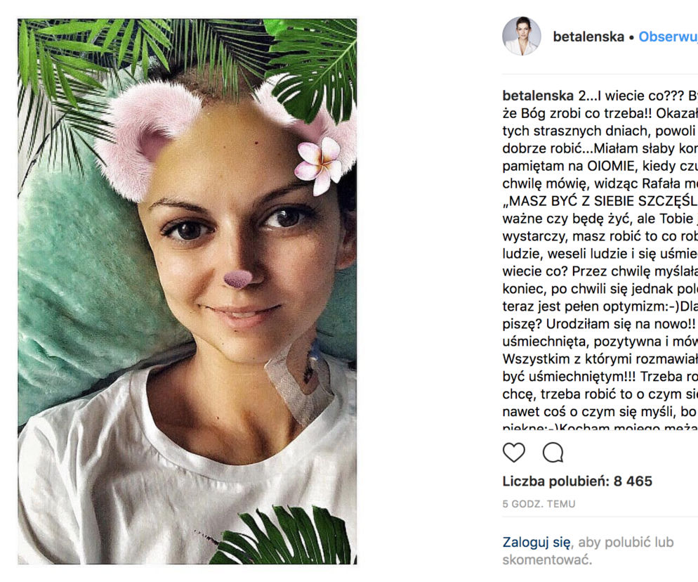 Alżbeta Lenska miała operację mózgu. Wzruszające słowa aktorki