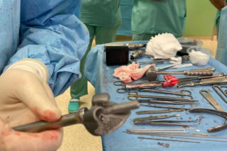 Wydrukowali kość na drukarce 3D i wstawili pacjentowi. Wyjątkowa operacja w Lublinie [GALERIA]
