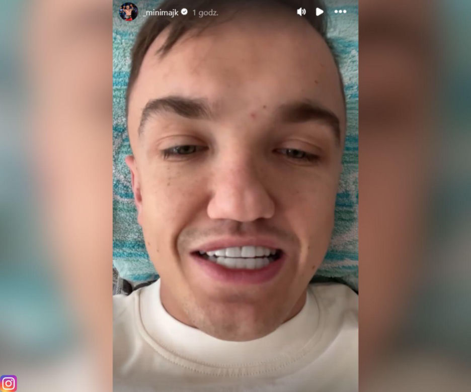 Mini Majk zobaczył, jak za rok będą wyglądały jego nowe zęby