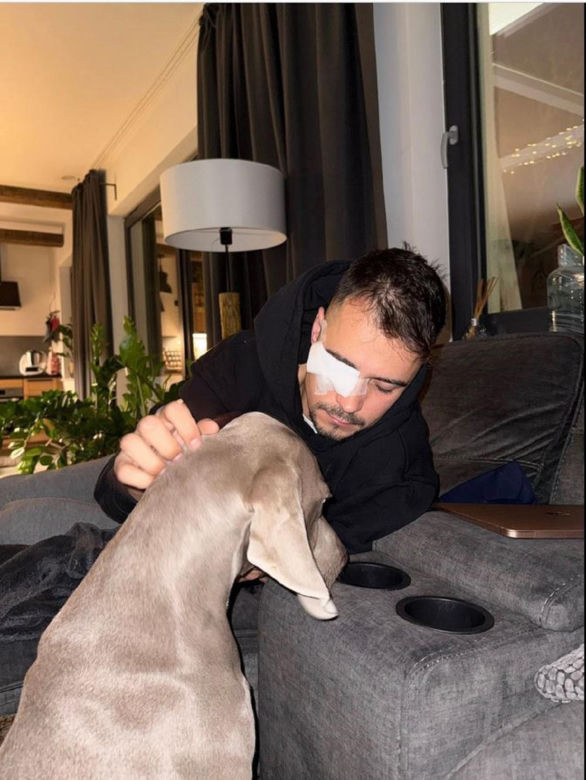 Polski influencer miał wypadek. Ucierpiało jego oko