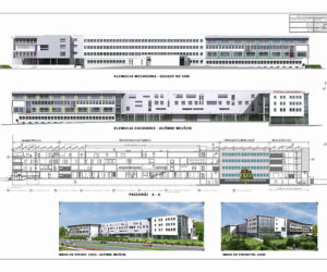 Szpital Złotniki – elewacja zachodnia i wschodnia