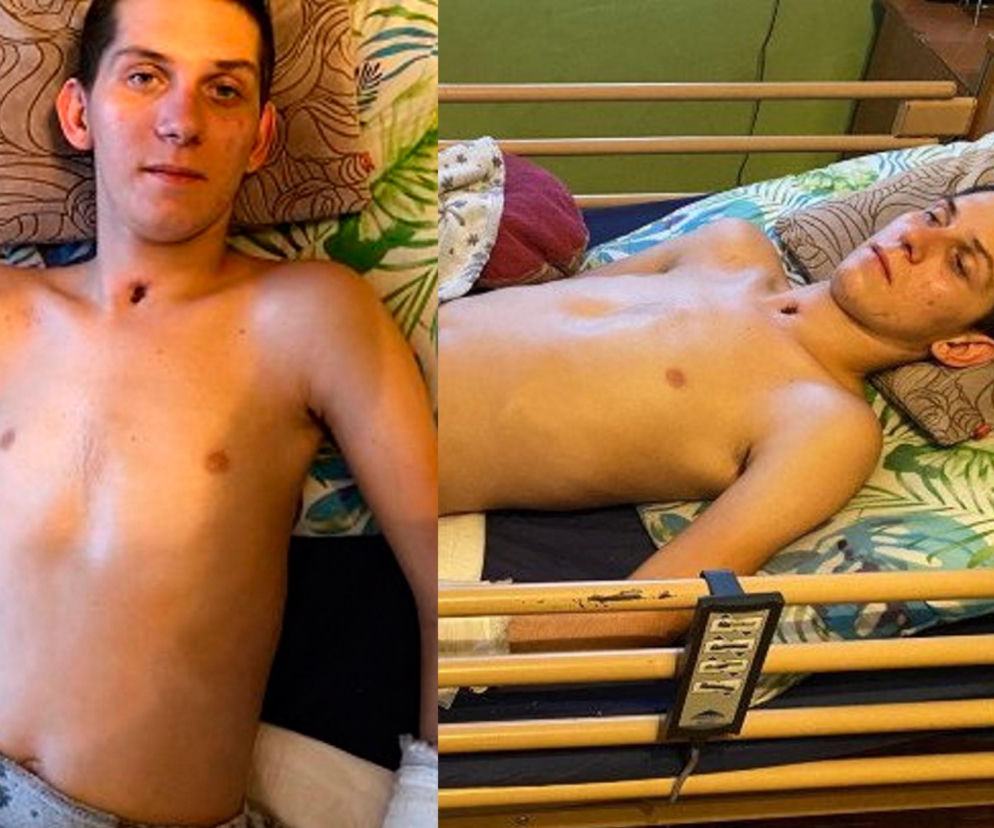 Łukasz wpadł pod ciągnik. To duża trauma Rodzina błaga o pomoc