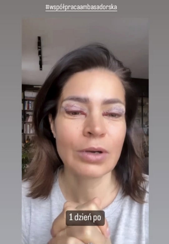 Joanna Górska wycięła sobie powieki. Drastyczne zdjęcia 