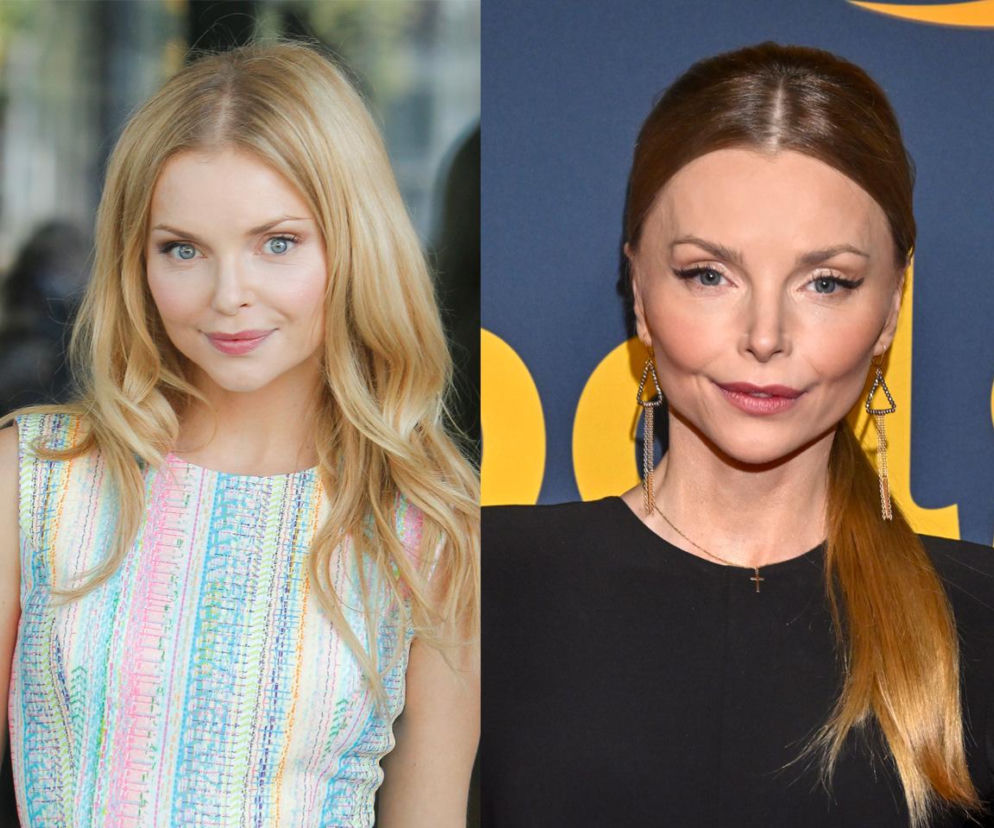 Izabella Miko wprost o operacjach plastycznych. Ma jasne stanowisko