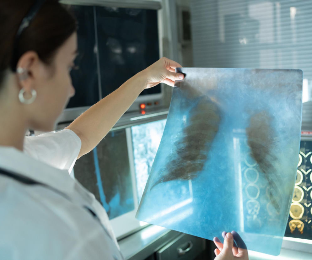 Obraz bez opisu - materiał na naszym portalu