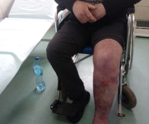 Lekarze nic nie zrobili, pielęgniarka tylko zmywała krew