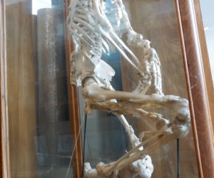 Muzeum Zakładu Medycyny Sądowej w Krakowie. Tu przechowuje się narzędzia głośnych zbrodni [ZDJĘCIA]