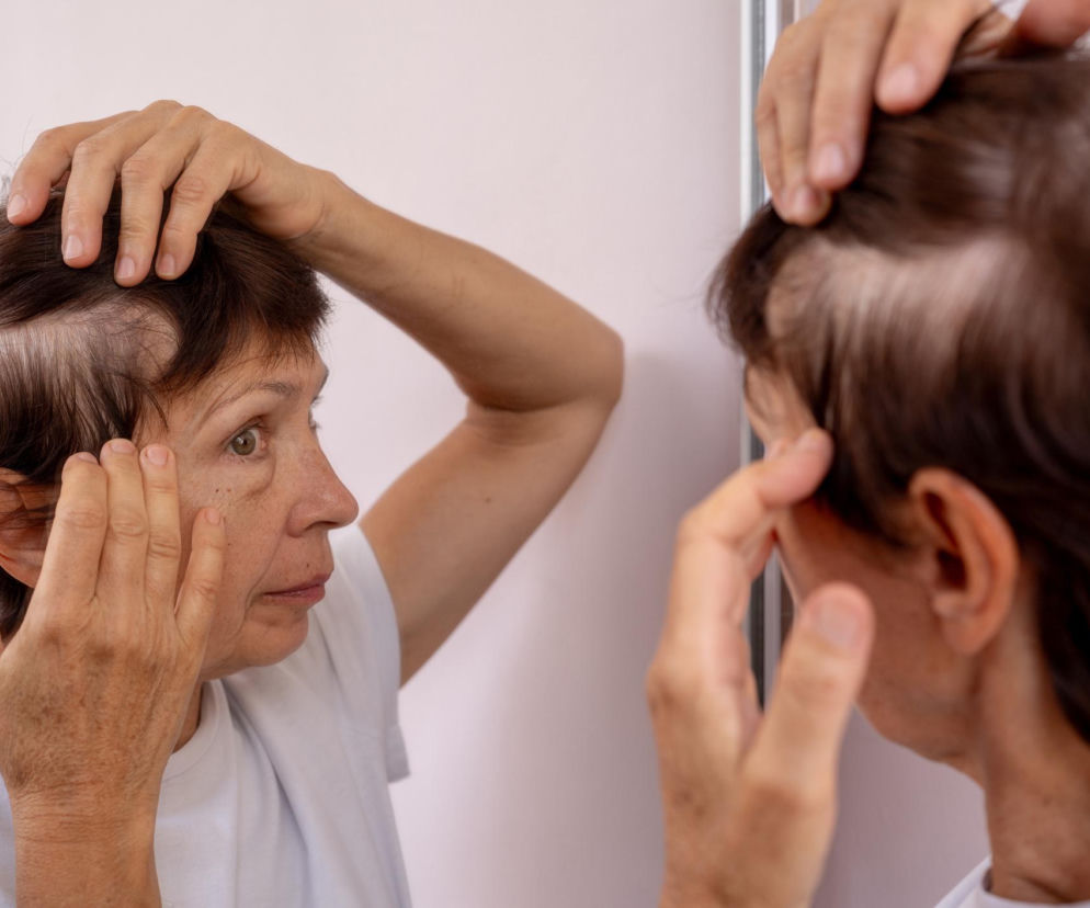 Włosy wypadają po 50. roku życia? Nie zawsze winna jest menopauza