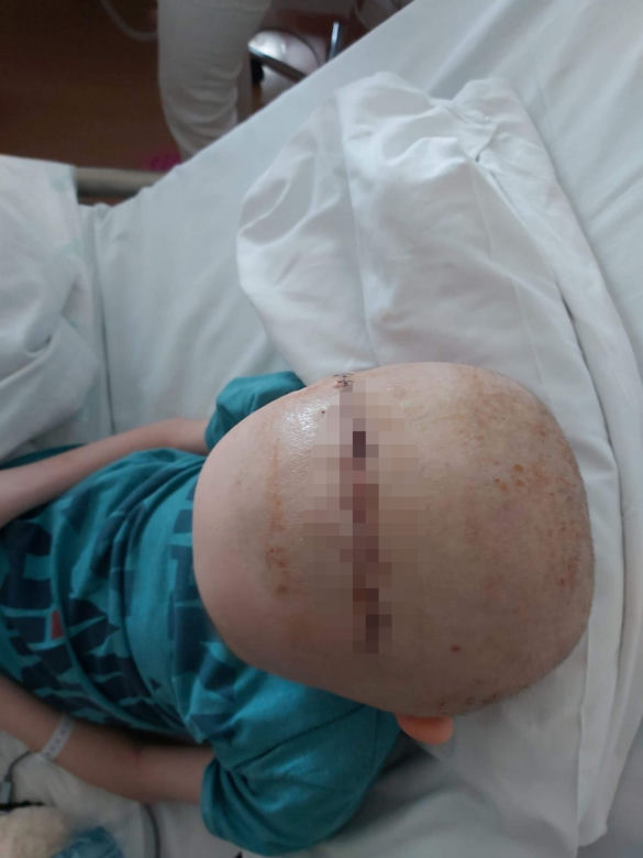 11-latek dwa lata czeka na rehabilitację