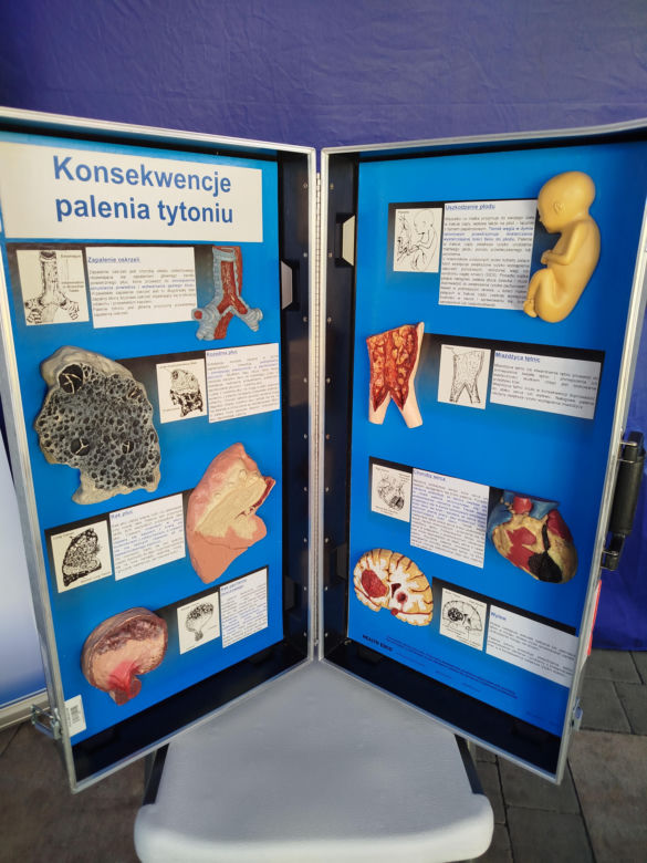 II Piknik Edukacyjno-Zdrowotny „Zdrowe Serce – Silne Siedlce”