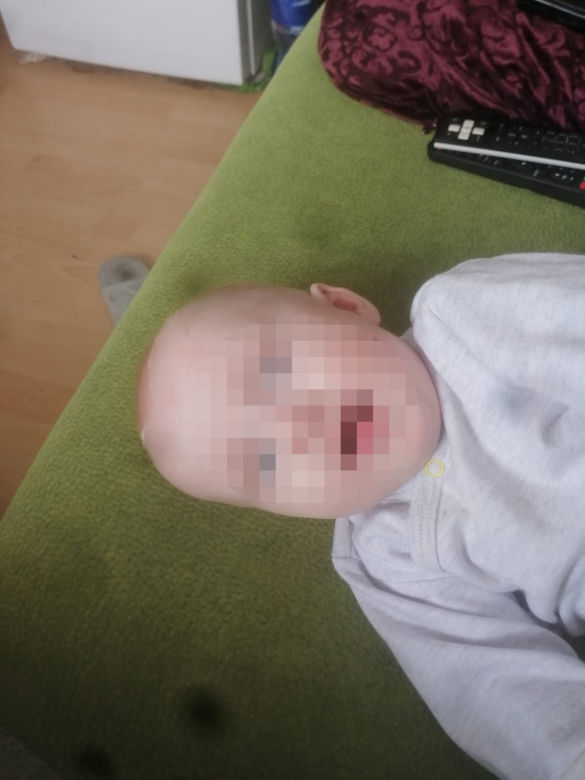 Tata rocznej Ani, która zginęła w pożarze nie może pogodzić się ze stratą córeczki