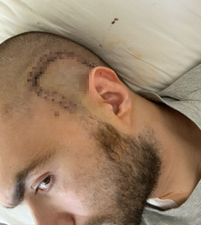 Sebastian rozpoczyna drugą wojnę z glejakiem. Dramatyczny apel o pomoc