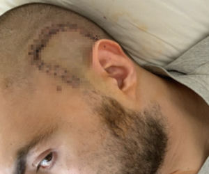 Sebastian rozpoczyna drugą wojnę z glejakiem. Dramatyczny apel o pomoc