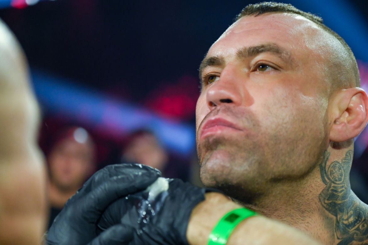 Paczuski: Potworne rozcięcie na twarzy gwiazdy KSW