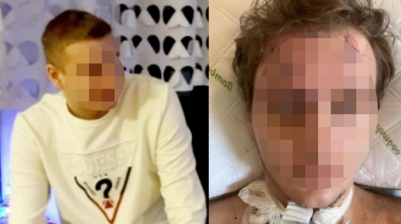 Świerklaniec. 31-latek doprowadził do dwóch wypadków. 5 osób rannych