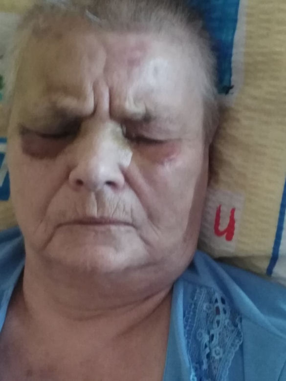 Wstrząsająca relacja pani Grażyny na Facebooku