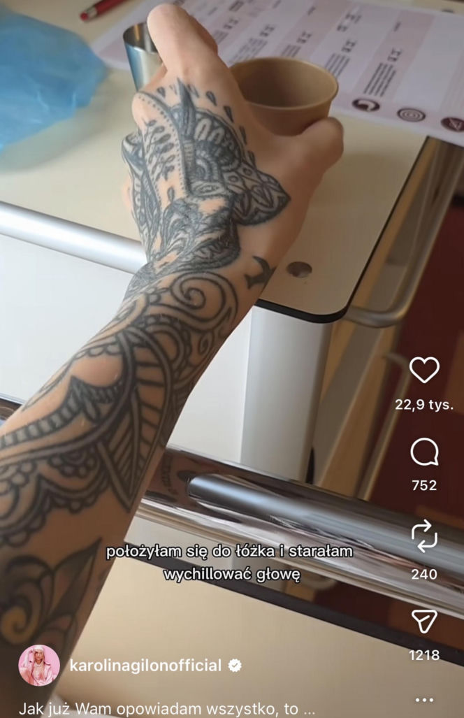 Karolina Gilon zoperowała biust. Zdjęcia przed i po