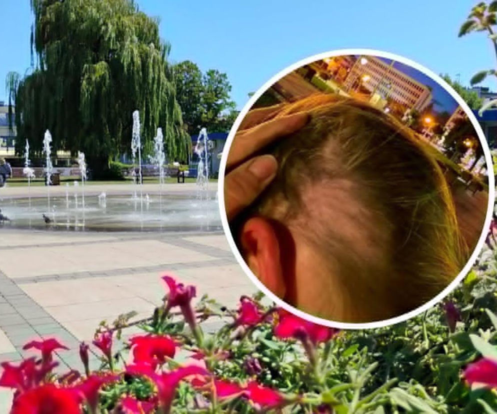 Plac z fontanną w Siedlcach. Na miniaturze obrażenia głowy dziewczynki. O ataku na 13-latkę przeczytasz na Eska Siedlce.
