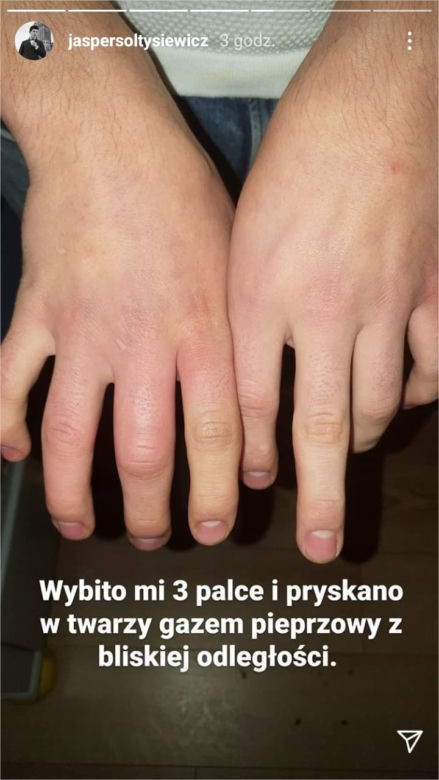 Gwiazdror "Barw szczęścia" oskarża policję o brutalne pobicie
