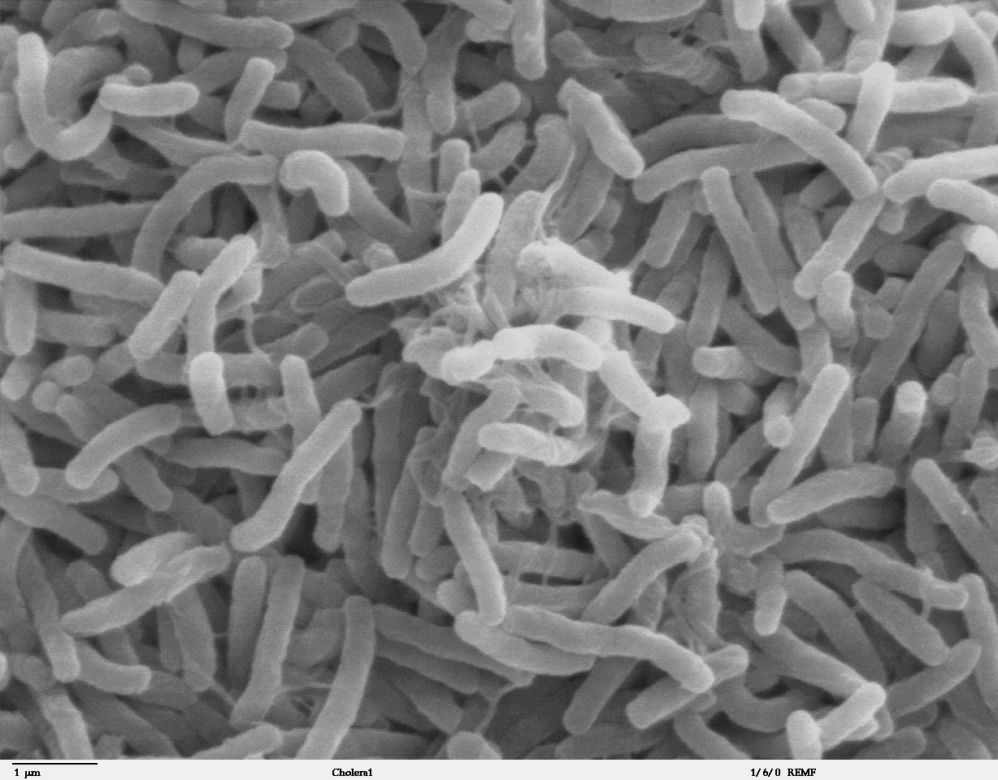 Dżuma, cholera, ptasia grypa, a teraz Covid-19. Jak kiedyś radzono sobie z epidemią?