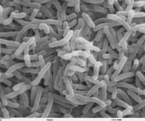 Dżuma, cholera, ptasia grypa, a teraz Covid-19. Jak kiedyś radzono sobie z epidemią?