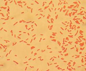 Bakteria E.coli wybarwiona