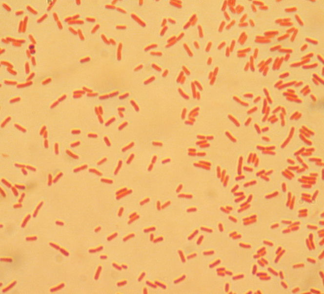 Bakteria E.coli wybarwiona
