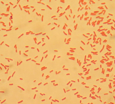Bakteria E.coli wybarwiona