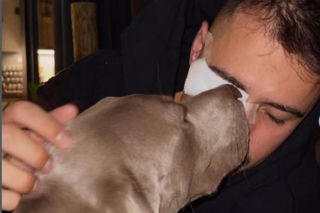 Polski influencer miał wypadek. Ucierpiało jego oko