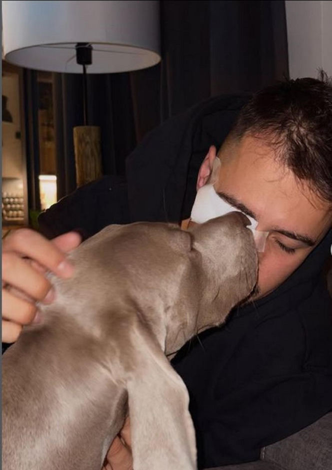 Polski influencer miał wypadek. Ucierpiało jego oko