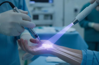 Polscy naukowcy zmieniają leczenie złamań. Śruby w kościach może zastąpić biomateriał 