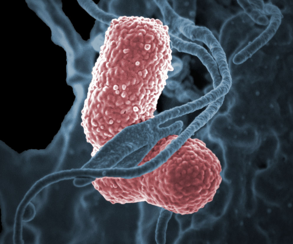 Mamy epidemię super groźnej bakterii New Delhi?