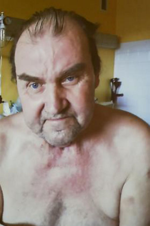 Przeszczepili organy szyi. Pan Tadeusz powiedział pierwsze słowo od 7 lat!
