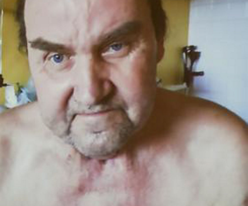 Przeszczepili organy szyi. Pan Tadeusz powiedział pierwsze słowo od 7 lat!