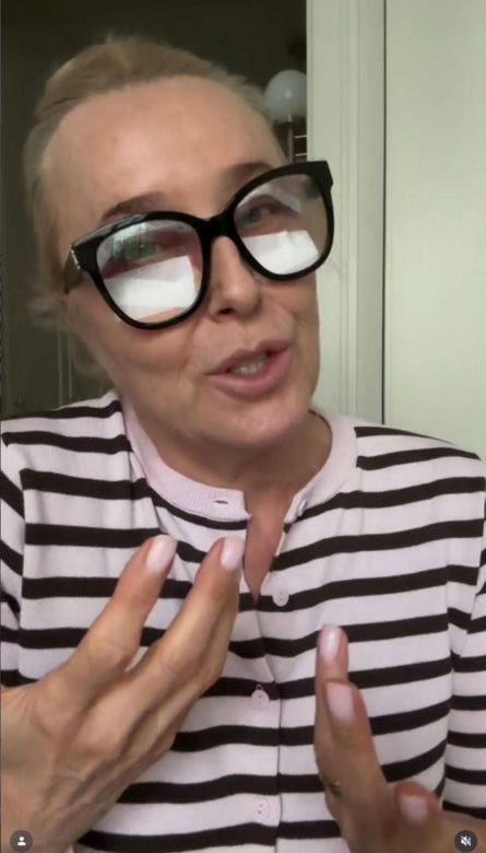 Agata Młynarska wycięła sobie powieki