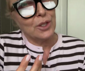 Agata Młynarska wycięła sobie powieki