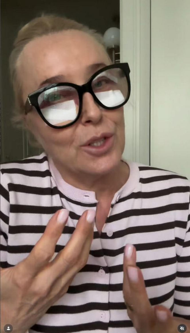 Agata Młynarska wycięła sobie powieki