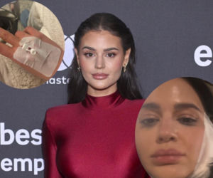 Piękna gwiazda trafiła na SOR. Jej twarz została zmasakrowana. Pokazała zdjęcie ze szpitala