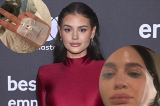 Piękna gwiazda trafiła na SOR. Jej twarz została zmasakrowana. Pokazała zdjęcie ze szpitala