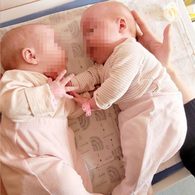 Siostry rozdzielone tuż po porodzie. Lekarze nie mieli innego wyjścia. Rodzice dziewczynek nie chcą się poddać [ZDJĘCIA]