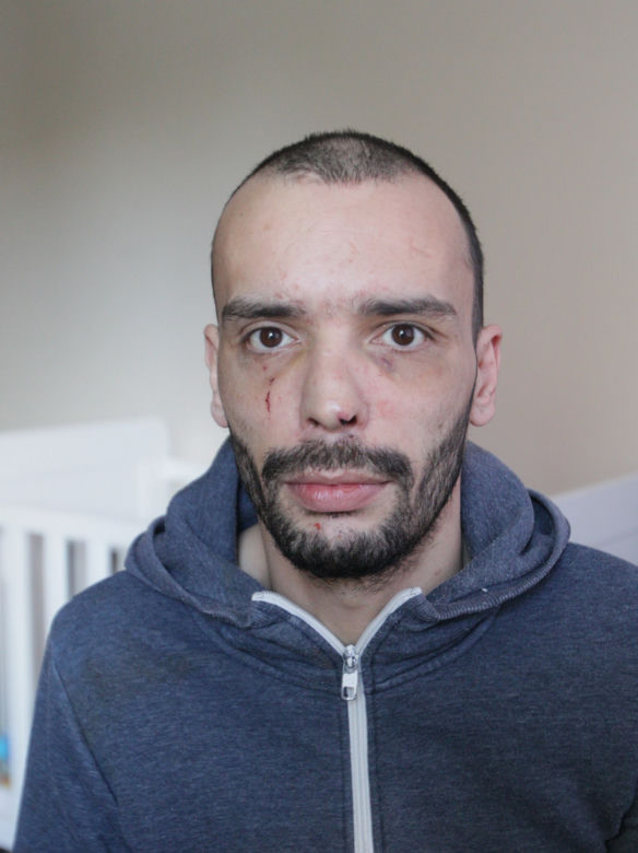 Damian w skutek pobicia trafił do szpitala. 