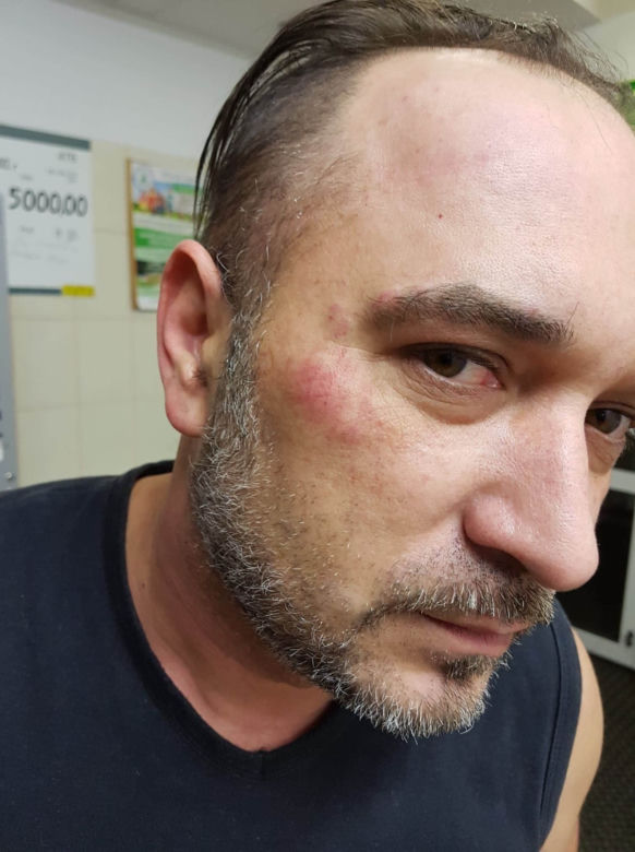 Dostałem zawału przez policję