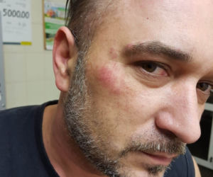 Dostałem zawału przez policję