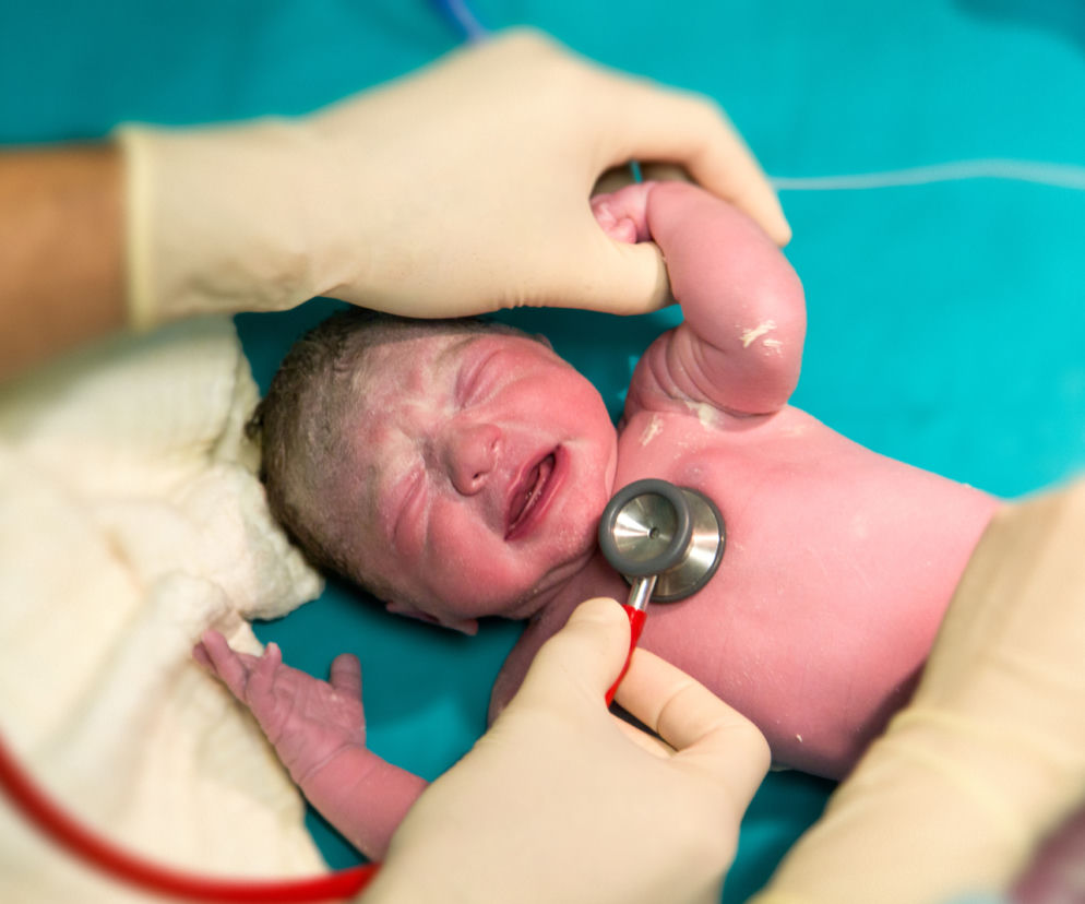 Jak wygląda noworodek po porodzie? To nie powinno cię dziwić w wyglądzie noworodka