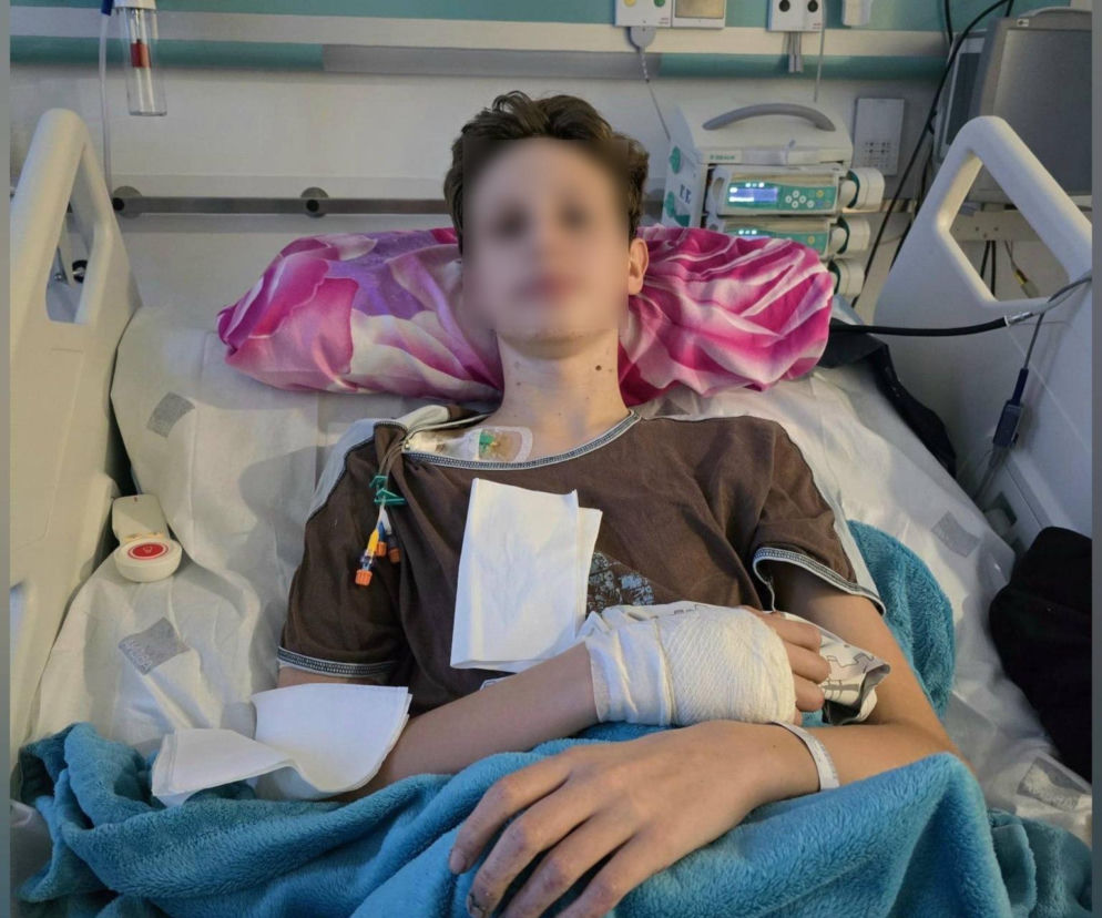 Zabawa petardami zamieniła dom w ruinę. 14-letni Szymon walczy o zdrowie!