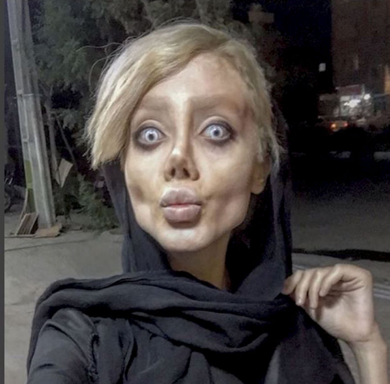 Chciała wyglądać jak Angelina Jolie