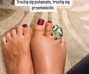 Agnieszka Hyży miała odpoczywać. Nagle doszło do bolesnego wypadku!