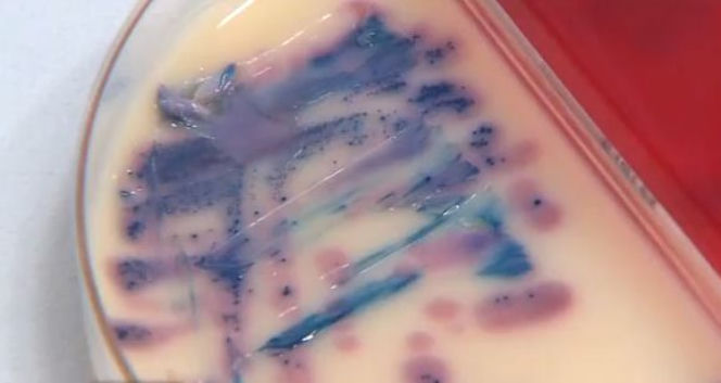 Jak atakuje bakteria E. coli - krok po kroku